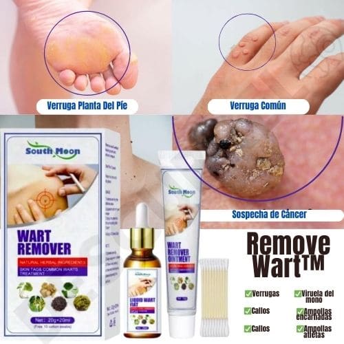 Remove Wart™ - 2x1 Sérum Eliminador De Verrugas + Crema Aclarante ❤️‍🩹